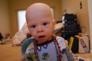 Aftermath Commits to Children’s Cancer Non-Profit, Beat Nb